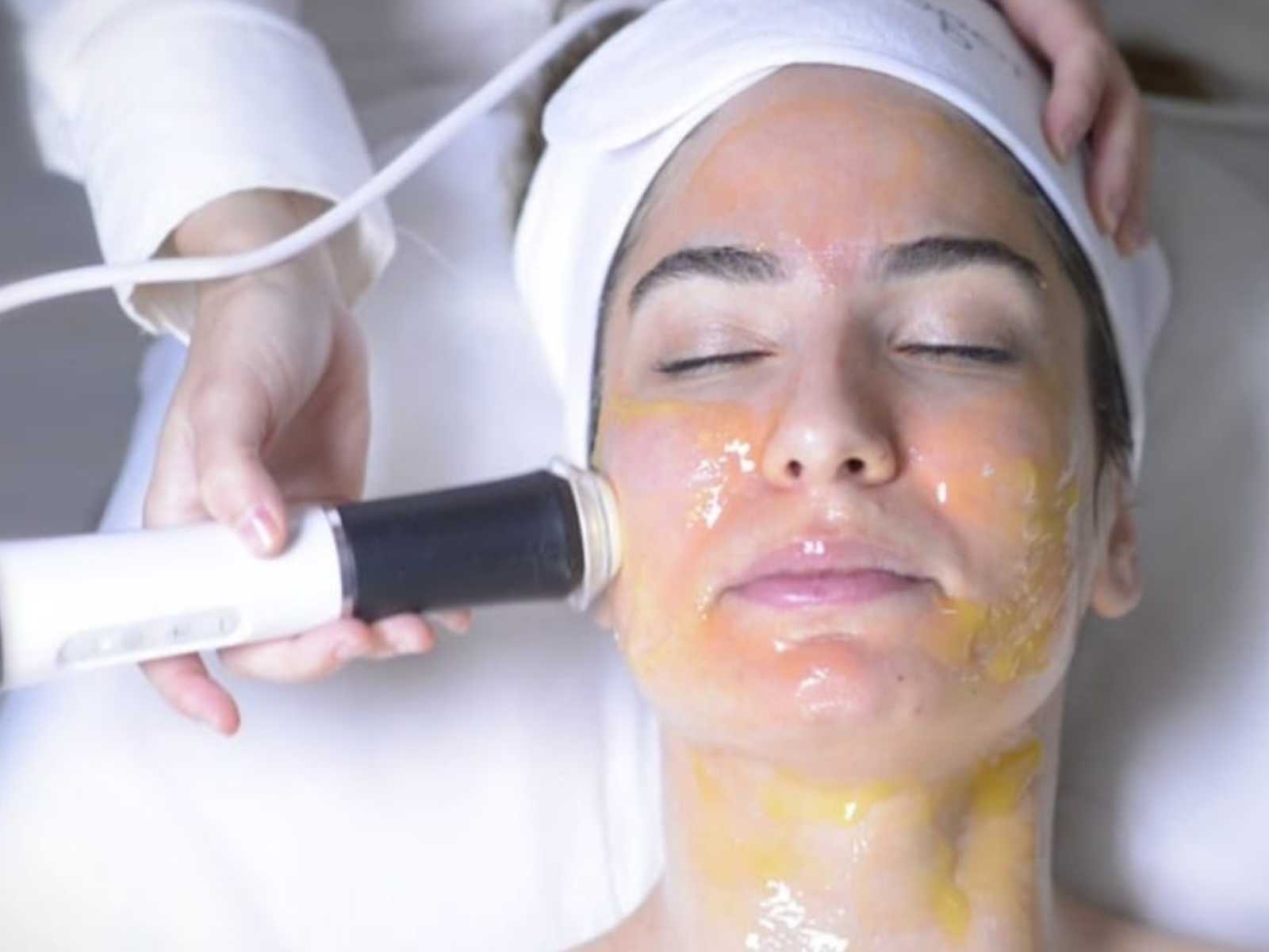 Безинъекционная карбокситерапия